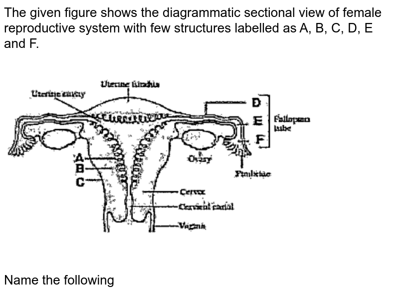 The Figure Given Below Depicts A Diagrammatic Sectional View Of Th