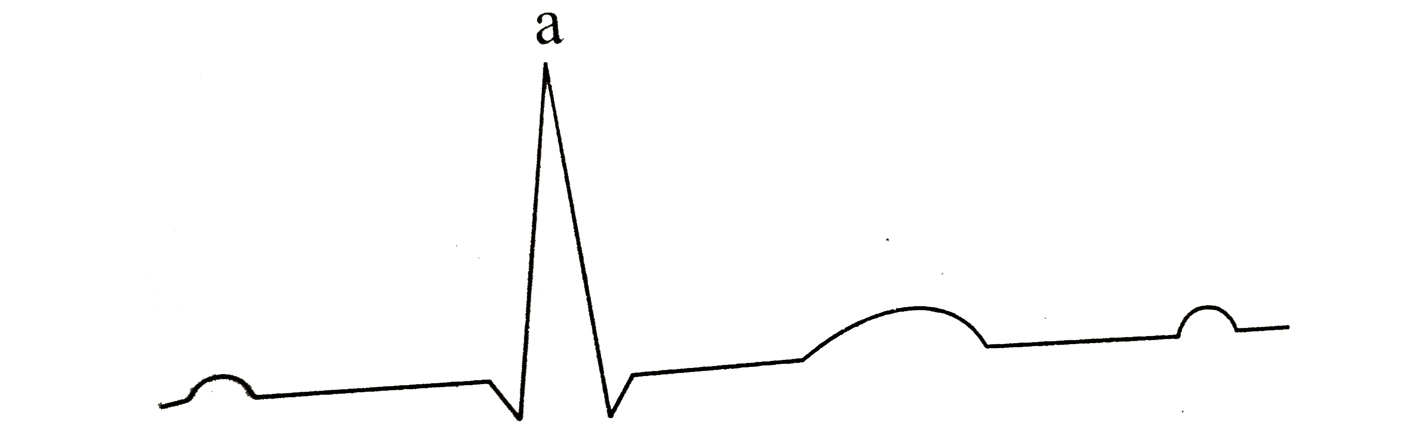 In this figure, peak point (a) is represented by letter