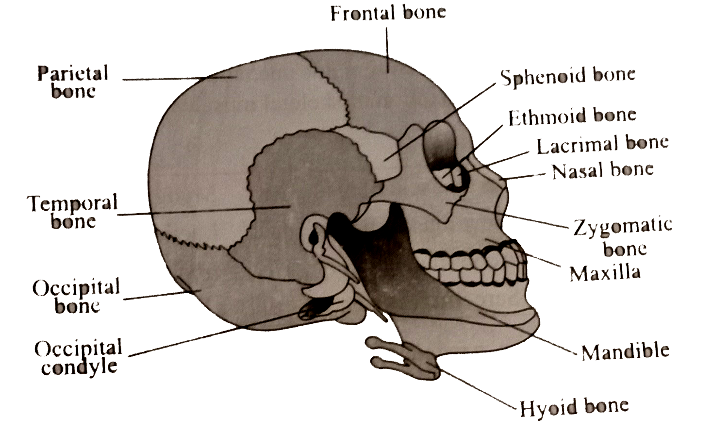 B Parietal Bone D Occipital Bone A Frontal Bone C Temporal Bone 5074