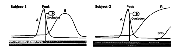 Case ! To answer the questions, study the graphs below for Subject 1 and 2 showing different levels of certain hormones.       For subject 2 it is observed that the peak for hormone B has reached the plateau stage. After approximately how much time will the curve for hormone B descend?