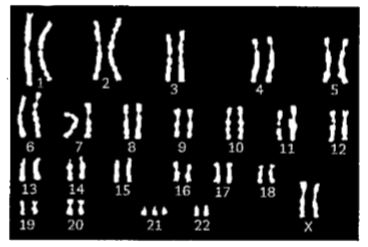 Placed below is a karyotype of a human being..       On the basis of this karyotype, which of the following conclusions can be drawn: