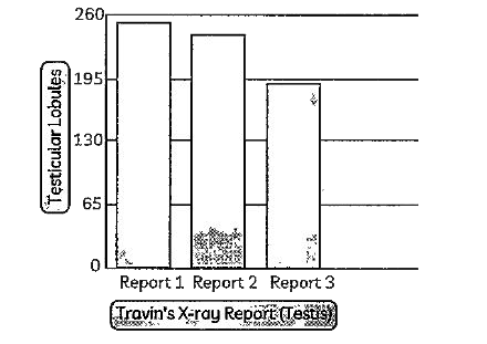 Study the graph and help Rakesh to find out which of these report(s) concerning the X-RAY of the testis in some random patients could be correct.