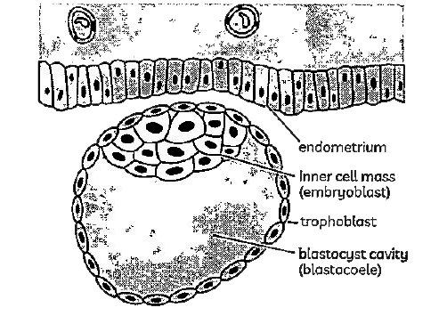 Which of the following statements are true related to given figure:       (I) Ectoderm is the outermost layer.   (II) Trophoblast is the outermost layer.   (III) The trophoblast layer attaches to the endometrium wall of mother's womb.   (IV)An inner group of cells attached to trophoblast is called the inner cell mass.