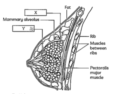 Observe the given diagram and find out the correct statement:      (I) X has mammary tubules which join to form Y.   (II) Y has mammary tubules which join to form X.   (III) X has mammary ampulla which join to form Y.   (IV) X has mammary duct which join to form Y.
