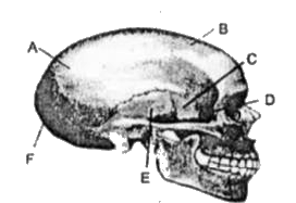 Study the following diagram of human skull and choose the option that correctly identifies two of the labels.
