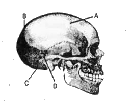 Study the following diagram of human skull and choose the option that correctly identifies one of the labels.
