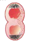 A stage in cell division is shown in the figure. Select the answer which gives correct identification of the stage with its characteristics