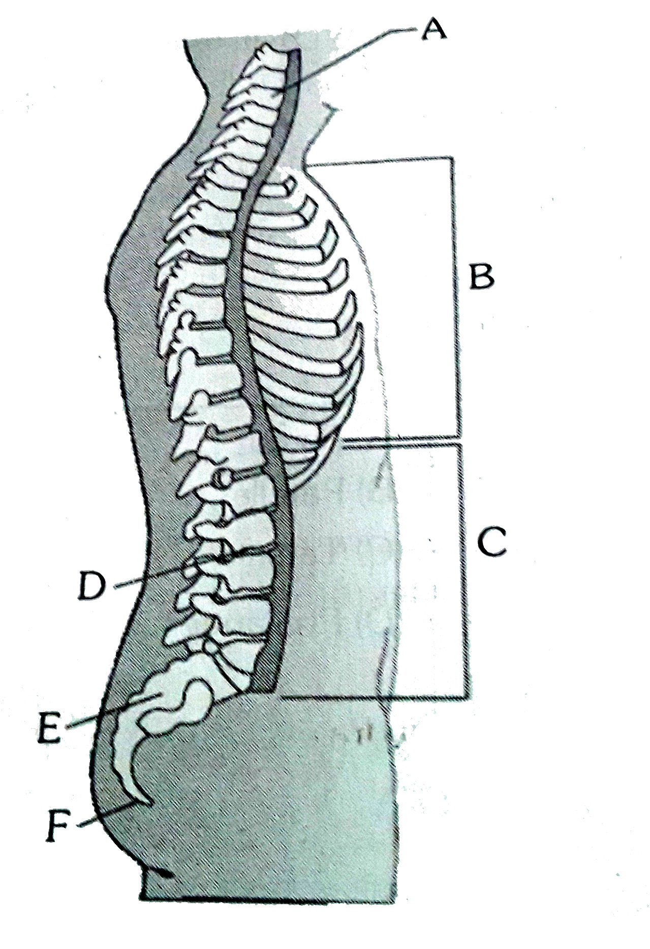 Idenfity thhe labelling A,B,C,D,E and F in the given diagra of vertebral column