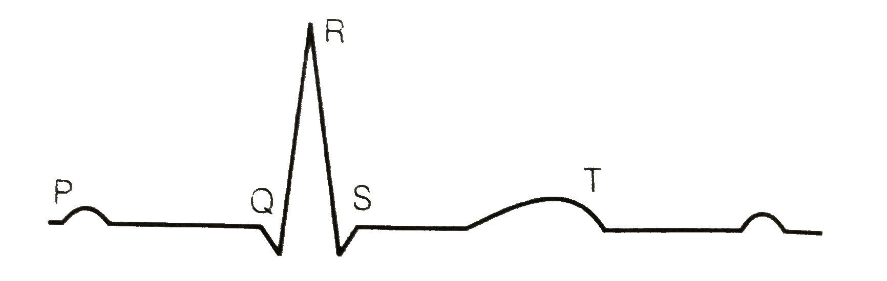 Given below is the diagrammatic representation of a standard ECG.Lable its different peaks.