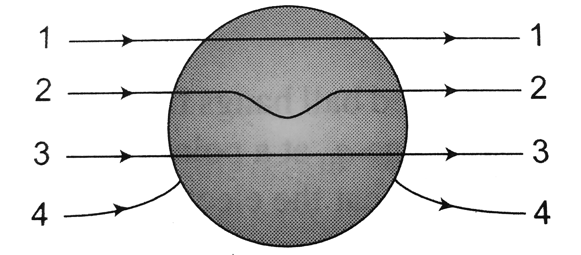 A metallic solid is placed in a uniform electric field. The lines of force follow the path (s) shown in figure as