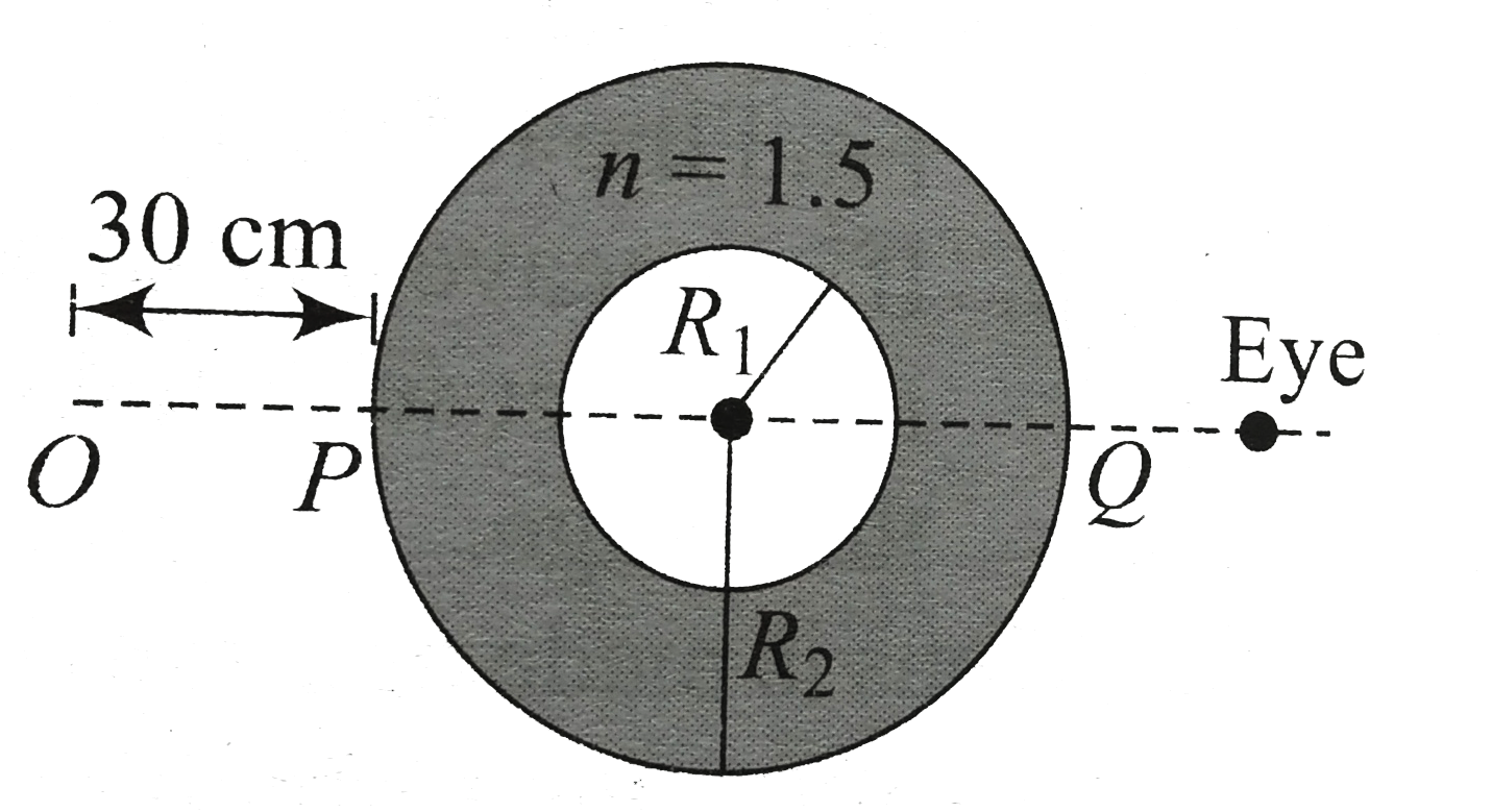 There is a spherical glass shell of refractive index 1.5, inner radius 10 cm and outer radius 20 cm. Inside th espherical cavity, there is air. A point object is placed at a point O at a distance of 30cm from the outer spherical surface. Find the final position of th eimage as seen eye.