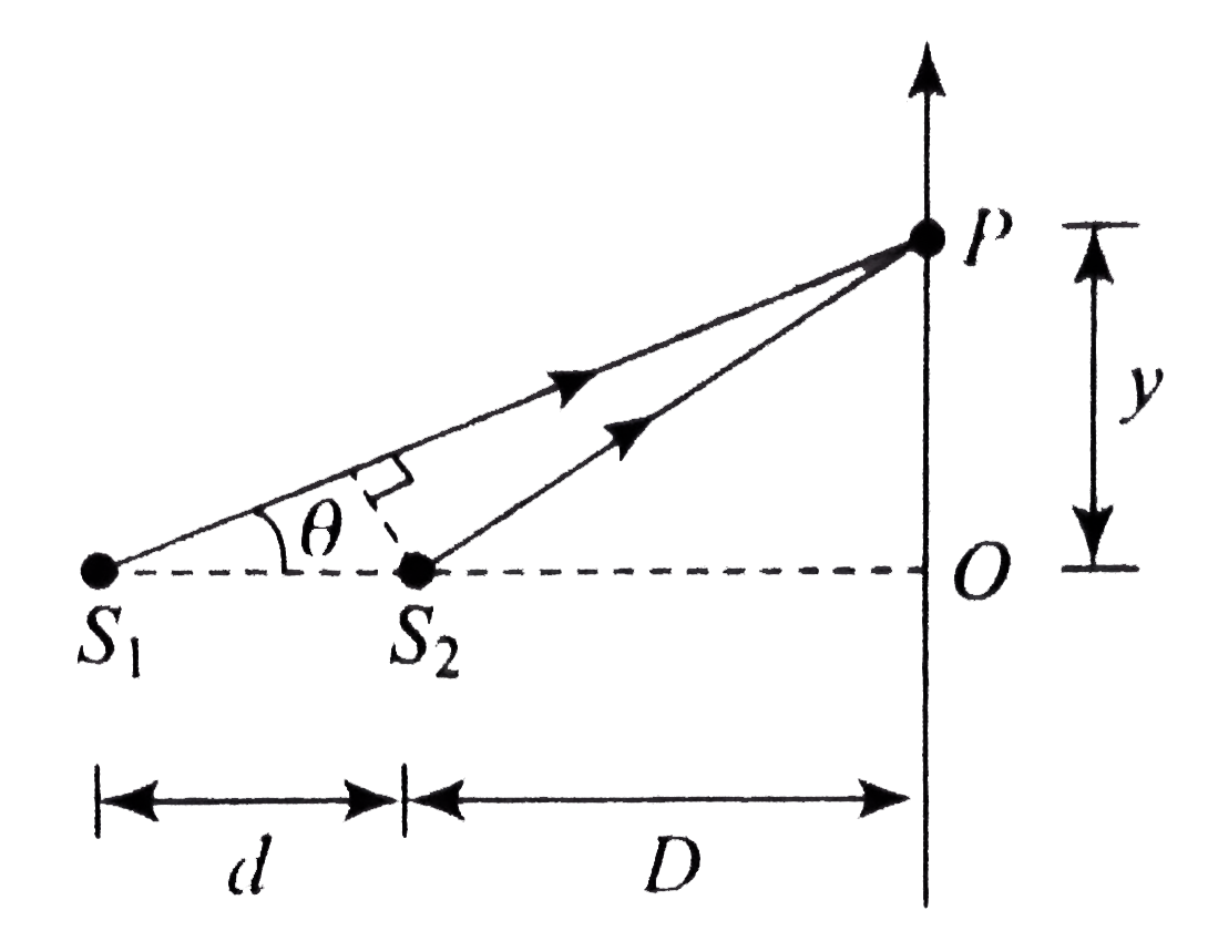 In figure, a screen is placed normaol to the line joining the two point coherent sources S(1) and S(2). The interference pattern consists of concentric circles.      If d = 0.5 mm, lambda = 5000 Å and D - 10 cm, find the value of n for the closest second bright ring.