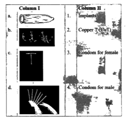 Match the columns I and II, and choose the correct combination from the options given.