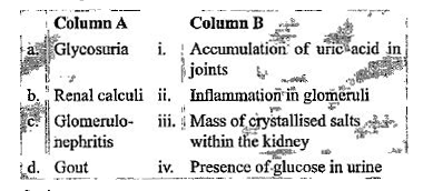 Match the abnormal conditions given in Column A with their explanations given in Column B and choose the correct option.