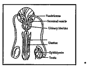 Consider the given picture What will be consequence it vasadeferntia is detached?