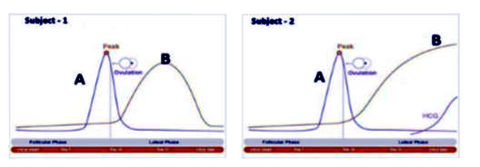 To answer the questions, study the graphs below for Subject 1 and 2 showing differentlevels of certain hormones.       Which of the following statements is true about the subjects?