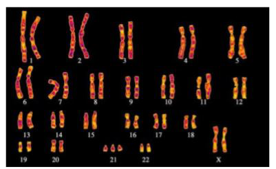 Placed below is a karyotype of a human being..      On the basis of this karyotype, which of the following conclusions can be drawn:
