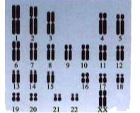 Use the following diagram to answer questions.      What would be the sex of the individual with the above chromosome complement?