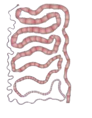 Identify the pathogen. Also, name the disease it causes.