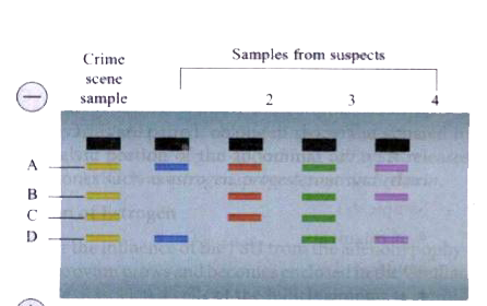 Observe the diagram of results of DNA fingerprinting and answer the following         The technique being used to assess this information is called