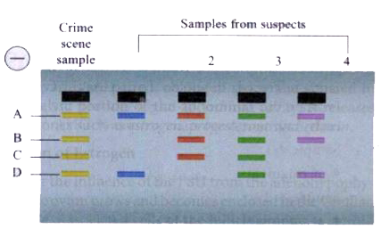 Observe the diagram of results of DNA fingerprinting and answer the following          Based on the results of this forensic investigation, it is likely that the guilty individual is