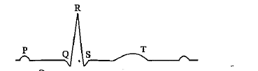 नीचे दिया गया ECG एक समान्य मानव का है। इसके किस एक घटक की, नीचे सही-सही व्याख्या की गयी है?
