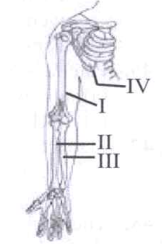 Which two bones form a hinge joint?