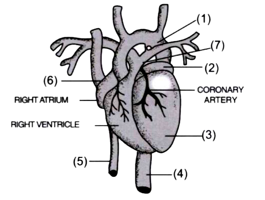 Given below is a diagram of the external features of the heart:      What happens if the coronary artery gets an internal clot?