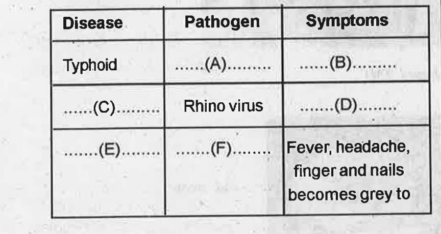 Complete the table by using hints from brackets. (Haemophilus influenzae, Common cold, Salmonella Ityphi, Running nose & Nasal congestion. Pneumonia, Ascariasis, Sustained fever39°C - 40°C, Malaria)