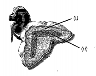 Identify the gland indicated in the picture and answer the following questions:   Name the hormone produced by the part indicated as (i) which slows down the action of defense cells.