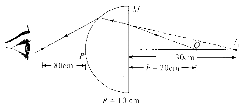 Figure shows a glass hemisphere M of mu = (3)/(2) and radius 10 cm. a point object O is placed at a distance 20 cm behind the flat face which is viewed by an observer from the curved side. Find location of final image after two refractions as seen by observer.