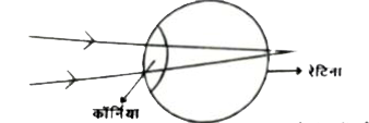 चित्र में आँख की बनावट का एक सरलीकृत स्वरुप दिया गया है , जिसमे आँख पर आपतित पूरे प्रकाश के अपवर्तन को कॉर्निया से होता माना जाता है। कॉर्निया आँख का सबसे अगला भाग है , जो लगभग 2 सेमी के एक नियत फोकस दूरी वाली अभिसारी लेंस होता है। अनन्त से आनेवाली समानान्तर किरणें कॉर्निया से अपवर्तित होकर रेटिना पर फोकसित प्रतिबिम्ब बनाती है। रेटिना प्रतिबिम्ब बनने की सूचना को प्रकाश तंत्रिका के माध्यम से मस्तिष्क तक पहुँचाती है।   निकट दिष्टि दोष एवं दूर दोष आँख में होने वाले दो समान्तर बीमारियाँ है। निकट दिष्टि दोष या मायोपिया में दूर से आने वाली किरणें कॉर्निया से अपवर्तन के बाद दूरस्थ वस्तु का प्रतिबिम्ब रेटिना के सम्मुख बना देती है।  दूर दिष्टि दोष या हाइपरोपिया में नजदीक की वस्तु का प्रतिबिम्ब कॉर्निया से अपवर्तन के बाद रेटिना से पीछे बनता है।  दोनों दोषों  को दूर करने के लिए उपयुक्त फोकस दूरी एवं प्रकृति का लेंस प्रयोग किया जाता है।  कॉर्निया तथा प्रयुक्त लेंस का संयुक्त समूहन प्रतिबिम्ब को पुनः रेटिना पर ले आता है। यदि दूर की वस्तु को अनन्त पर मान जाए तब कॉर्निया से प्रतिबिम्ब की दूरी को निम्नलिखित सूत्र से ज्ञात किया जा सकता है :   (1)/(fc)+(1)/(f(1)-x)=(1)/(v),f(c)= कॉर्निया की फोकस - दूरी   f(1)= संशोधी लेंस की फोकस - दूरी   x= कॉर्निया एवं अतिरिक्त लेंस के बीच की दूरी   सामान्य दोषमुक्त आखों में कॉर्निया से कितनी दूरी पर रेटिना होना चाहिए ?