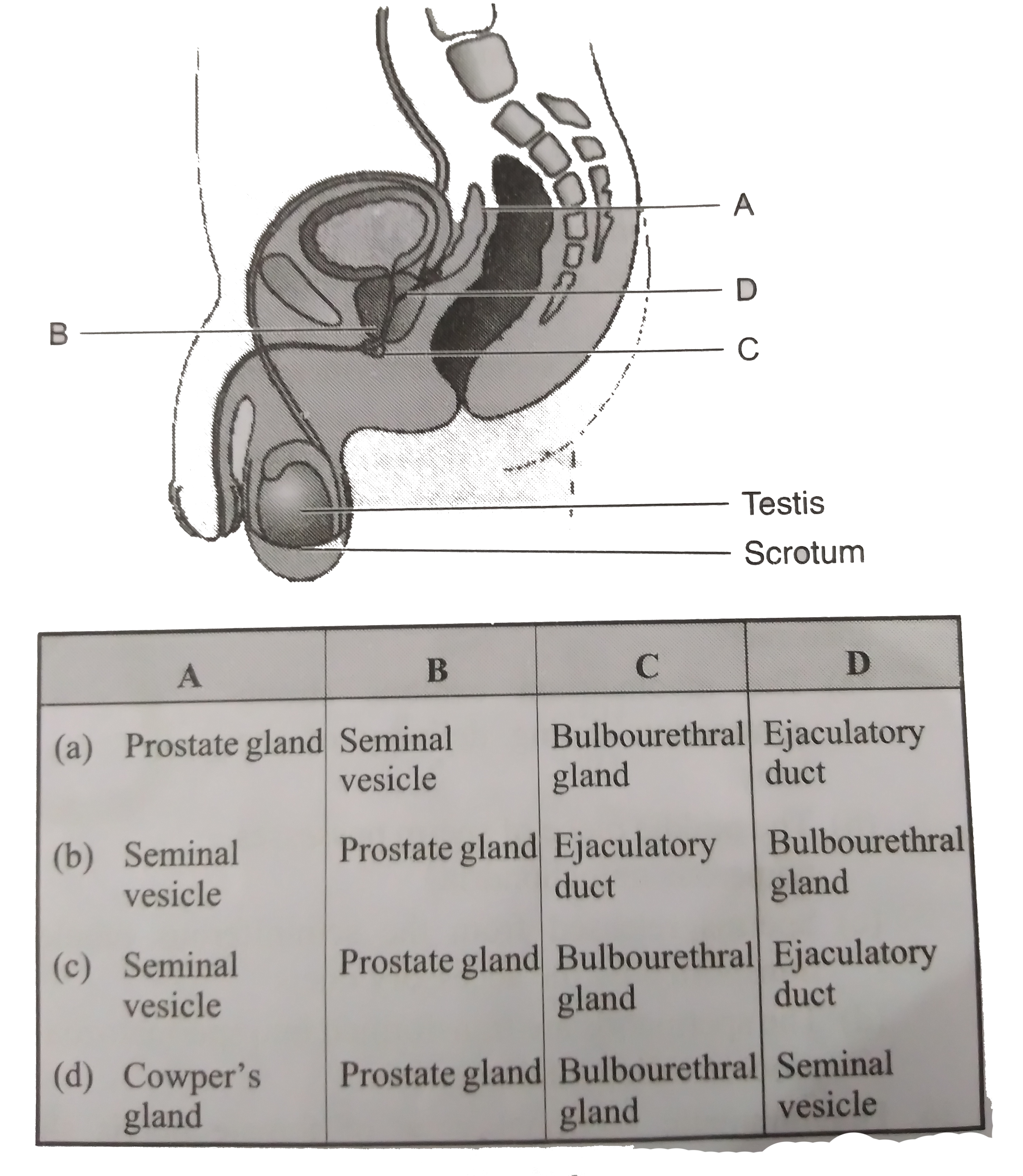 Diagrammatic sectional view of male pelvis showing reproductive system Is given below. Select the correct option: