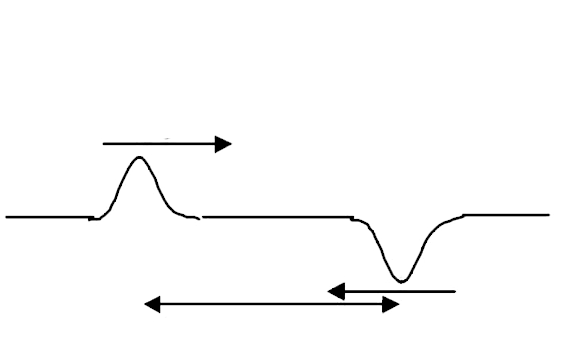 Two pulse in a stretched string whose centers are initially 8cm apart are moving towards each other as shown in the figure. The speed of each pulse is 2cm//s. After 2seconds, the total energy of the pulse will be