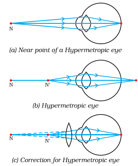 ocr_image