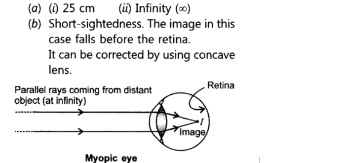 ocr_image