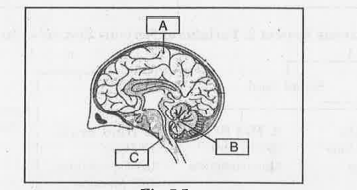 Label the parts of human brain