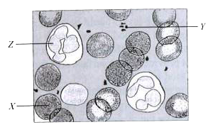 Observe the given figure of blood smear prepared by a lab professional.         Identify cells X, Y and Z and select the correct statement