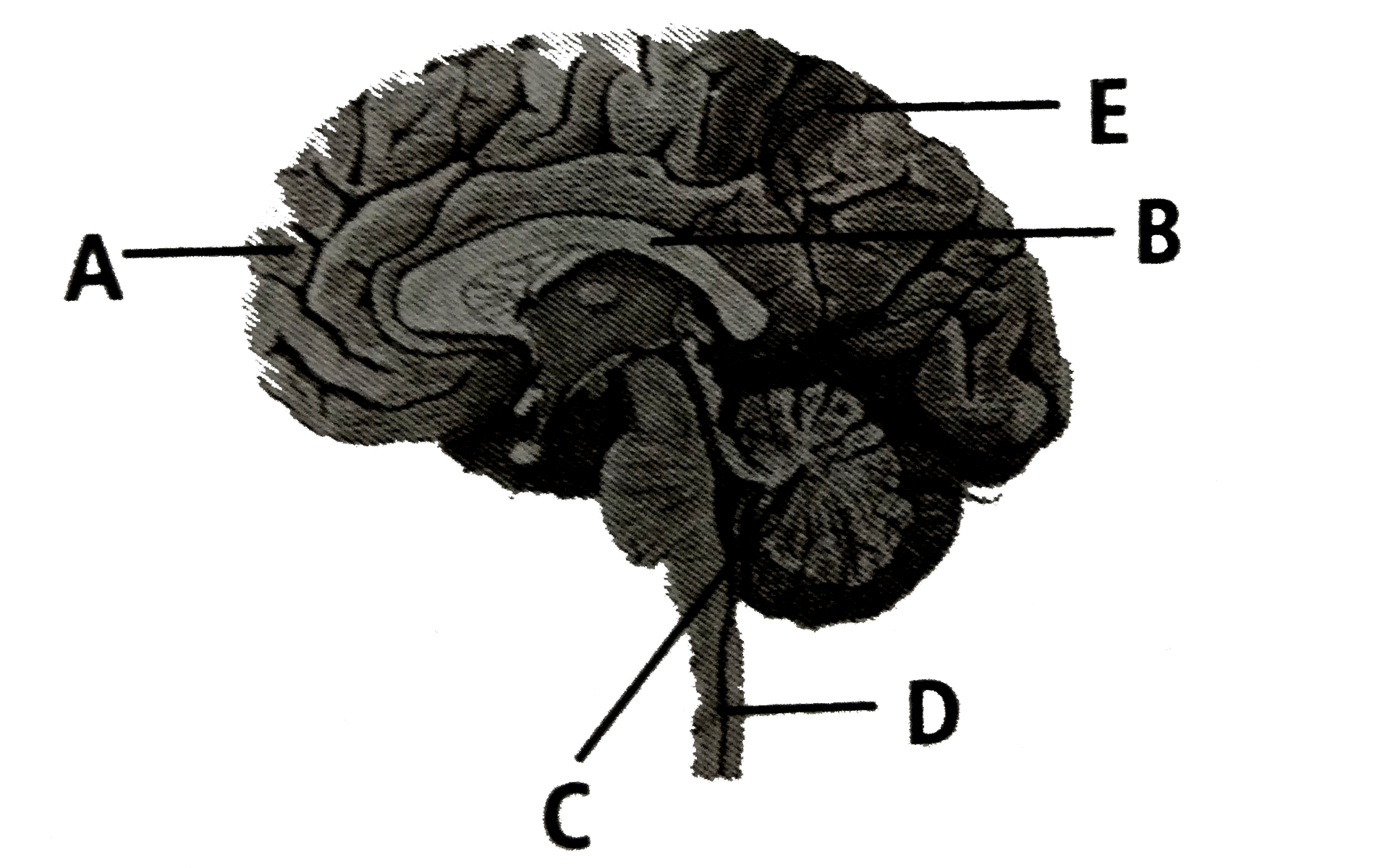 The given figure shows lateral view of the human brain.Identify the parts labelled as A to E and select the correct option.