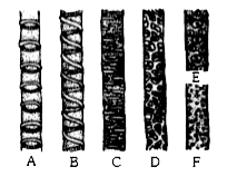 The following diagrams show the types of secondary thickenings in the xylem vessels. Identify the types labeled from A to F. Choose the correct option from those given