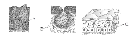 See the following figures      Figure A and B indicate glands while Figure C indicates specific type of tissues. Identify A, B and C