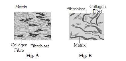 Identify the following figure – A and B respectively