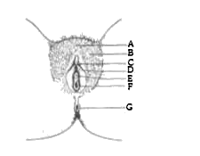 Identify the parts labelled (A to G) in the following diagram of the vulva, from the list I to VIII    I. Anus     II. Glans clitoris    III. Labia majora      IV. Labia minora    V. Mons pubis      VI. Urethra     VII. Vagina