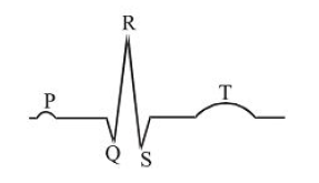 In given ECG, end of T-wave marks