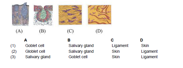 Following are the four diagrams given, choose correct option indicating the example belonging.