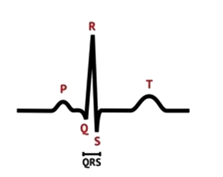 नीचे दिया गया एक सामान्य मानव का ECG है। तरंग और इसकी संबद्ध विद्युत सक्रियता के सही मिलान की पहचान कीजिए।