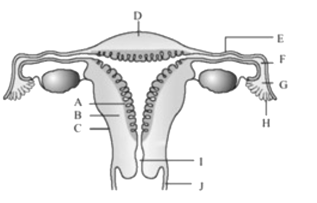 Diagrammatic view of female reproductive system is given below. Select the incorrect option on the basis of labls given .