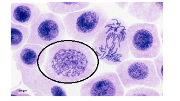 Identify the circled phase of cell division .