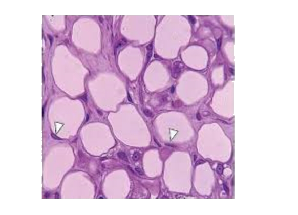 Identify the cross-sectional view of the loose connective tissue given below and select the correct statement.