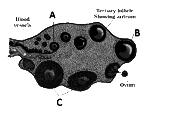The figure shows a section of the human ovary . select the option which gives the correct identification of A,B,C .       (i) A is a group of primary follicles that gradually matures under the influence of LG and FSH    (ii) C is the Graafian follicles which starts producing a hormone celled progesterone.   (iii) C is a corpus luteum that secretes FSH.   (iv) B is the Graafian follicles which ruptures during mid of the cycle.